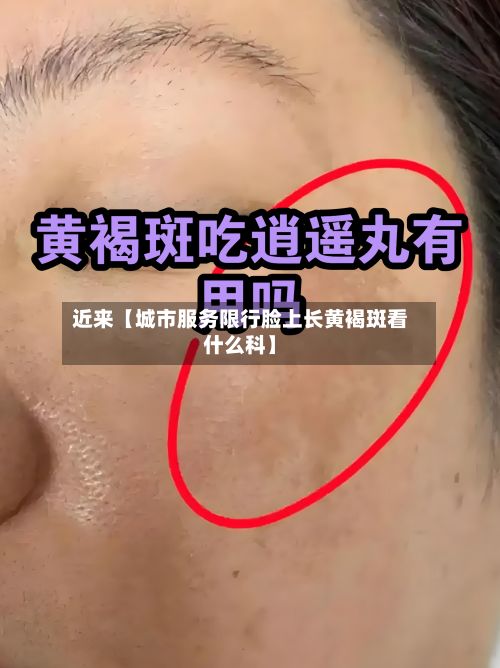 近来【城市服务限行脸上长黄褐斑看什么科】