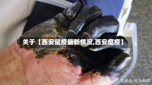 关于【西安鼠疫最新情况,西安瘟疫】